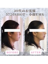 ラ セラフィータ 中目黒/【上級小顔】EMS美容液導入付き