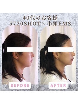 ラ セラフィータ 中目黒/【上級小顔】EMS美容液導入付き