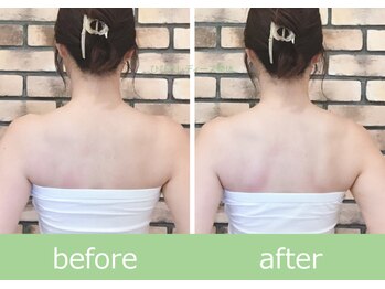 ひびきレディース整体 日吉/“天使の羽”で後ろ姿美人へ