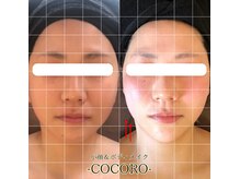 ココロ(COCORO)の雰囲気（人気No.1★立体小顔コルギはお体からケアして即効性と持続力UP）