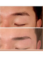 ジーニー(Genie)/ハリウッドブロウリフト