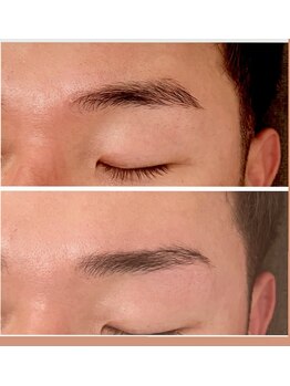 ジーニー(Genie)/ハリウッドブロウリフト