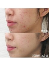 スリリアン 銀座/★お客さまビフォーアフター★