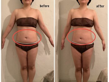 トリート(TREAT)/ビフォー&アフター Y様(前)