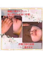 ノア/炭酸ヘッドスパ