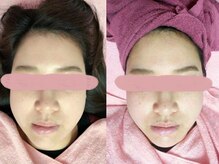 美容整体カラダリメイク(karada)/小顔矯正も人気です！