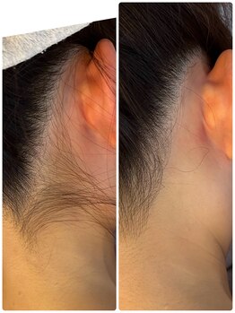 リクラ 北千住(Reclat)/ブライダルは当店で