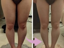マールム(MALUM)の雰囲気(痩せにくい下半身もすっきり美脚へ。自信の持てる後ろ姿に!)