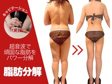 セルライト専門店【癒しゼロの熱血エステ】FEMBE錦糸町店【7/1　NEW OPEN（予定）】の雰囲気（【太もも/下半身】ダイエットで落ちない頑固な下半身こそ美脚に）
