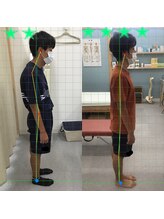 姿勢矯正院/お子さんの姿勢変化