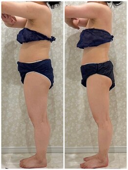 ディオーネ(Dione)/1ヶ月でこんなに変わります☆