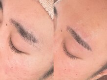 エムズハグ(M's hug)/眉毛ワックス/10代/下がり眉悩み