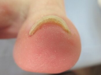 東京巻き爪研究所 みなみ風/