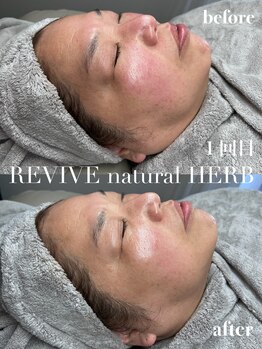 レヴィオ(Revio_)/