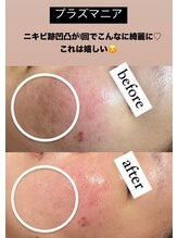 ビューティーネイル(Beauty Nail)/プラズマニア