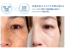 グランドール アンジョウ 安城(grandeur.anjo)の雰囲気（国産ヒト臍帯/羊膜幹細胞上清液エクソソーム【しわ,ほうれい線】）