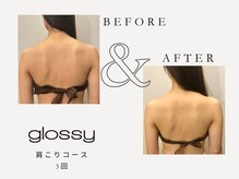 グロッシー(glossy)/機器を使用する肩こりコース