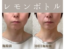 プチサロンエール(petit salon ailes)の雰囲気（レモンボトルで「痩せた？」と聞かれる小顔になれる♪）