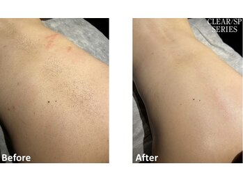 ベルフィオーレ(bel fiore)/