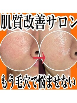 エステ ココ 土気店(Esthe CoCo)/#毛穴 #肌質改善