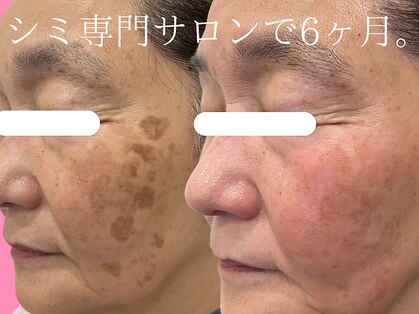 ハウオリ(HAUOLI)の写真