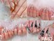 アモ ラブネイルズ 高崎駅前店(AMO Love nails)の写真