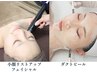 【女性用】小顔と美肌を同時に叶える◎リフトアップフェイシャル&ピーリング
