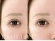 ベレアラッシュ 大森(Bellea Lash)の写真/【中顔面短縮・小顔効果★】安定人気のまつげパーマ/上下で中顔面短縮効果も期待/豊富なロッドで似合わせ♪