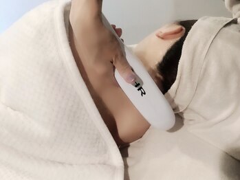 アフューレ(AFULE)/脱毛