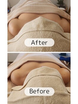 インナーライト(Inner-Light)/*Before &After*