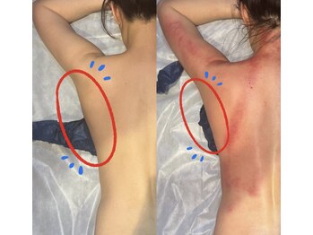 ジュエリーボディー(Jewelry body)/脇肉撃退!!