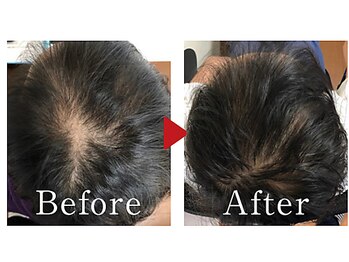 かがわ接骨院 高松伏石院/頭皮トラブルでお悩みの方!