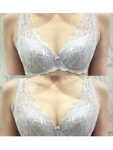 サロン アイミー(salon i me)/【バストアップ】症例