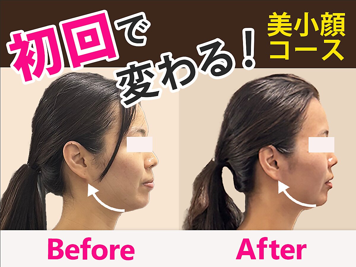 エンジェル(Angel)｜ホットペッパービューティー