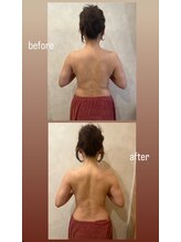 アステリア(A'steria)/腸活リンパエステでデトックス