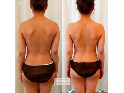 ミールーム(mi room)の写真