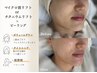 【人気No.3】選べる小顔ケア×肌悩み別ピーリング￥28,000→￥19,600