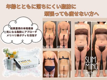 リ ビューティ リバティ(Re:Beauty LIBERTY)の写真/下半身太りのお悩みに◎メリハリ美ボディを叶える。太もも・ヒップを引き締めて憧れの美尻×美脚へ!