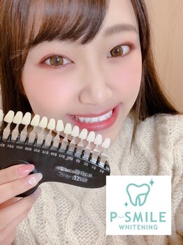 ホワイトベース(White Base)/お客様の施術後！！