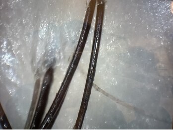 アランチャンティック(AlamCantik)/スコープによる頭皮チェック