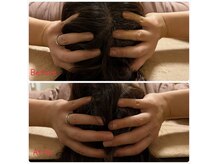 ベルフルール(Belle Fleur)の雰囲気（小顔矯正で顔だけでなく頭も小さくなります！）