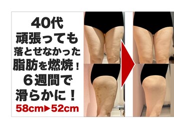 ボディアーキ 中野店(BODY ARCHI)/頑張っても落とせなかった脂肪が