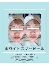 ソワナ(soina)/【神楽坂駅/フェイシャル/毛穴】