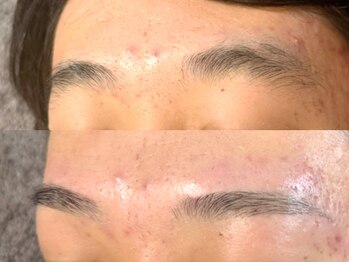 シーアットシュシュ(C at Chouchou)/メンズ眉毛Wax脱毛