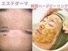 【毛穴レス美肌】エステ版ダーマ×ハーブピーリング×鎮静パック美肌LED 90分