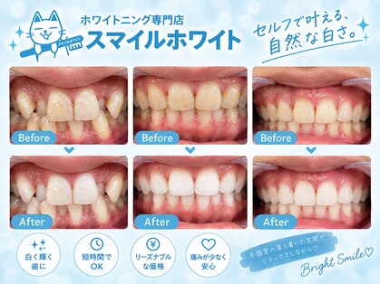 スマイルホワイトの写真