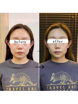 横浜DRT矯正院/小顔・美顔矯正