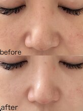 アトレ アンド ミューズ(Attrait×Muse)/ゾンビマスク