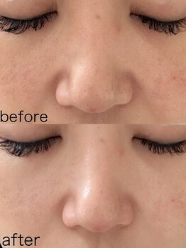 アトレ アンド ミューズ(Attrait×Muse)/ゾンビマスク