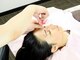 アキュピタル(acupital)の写真/【美容鍼灸専門店】お顔のむくみ改善でキュッと小顔に！全身整体＋美容鍼灸でお顔だけでなく身体も整える◎